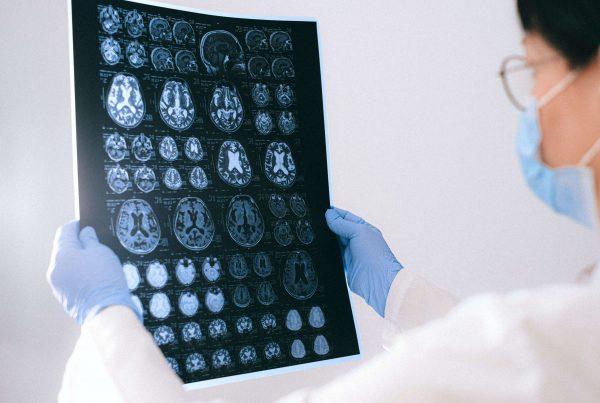 Neuroimaging