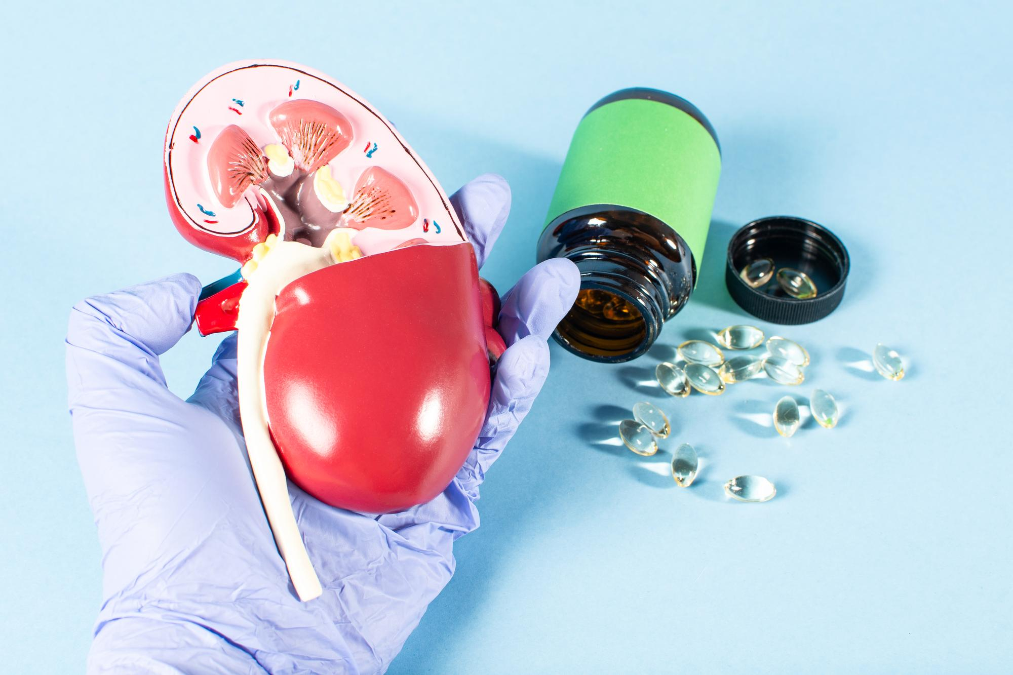 Understanding Kidney Stones, Taking Care, and How You Can Get Cured